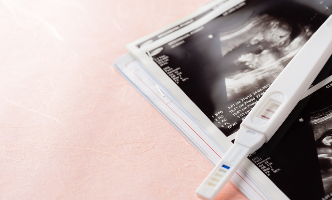 How Should You Select The Best Pregnancy Test Packages?