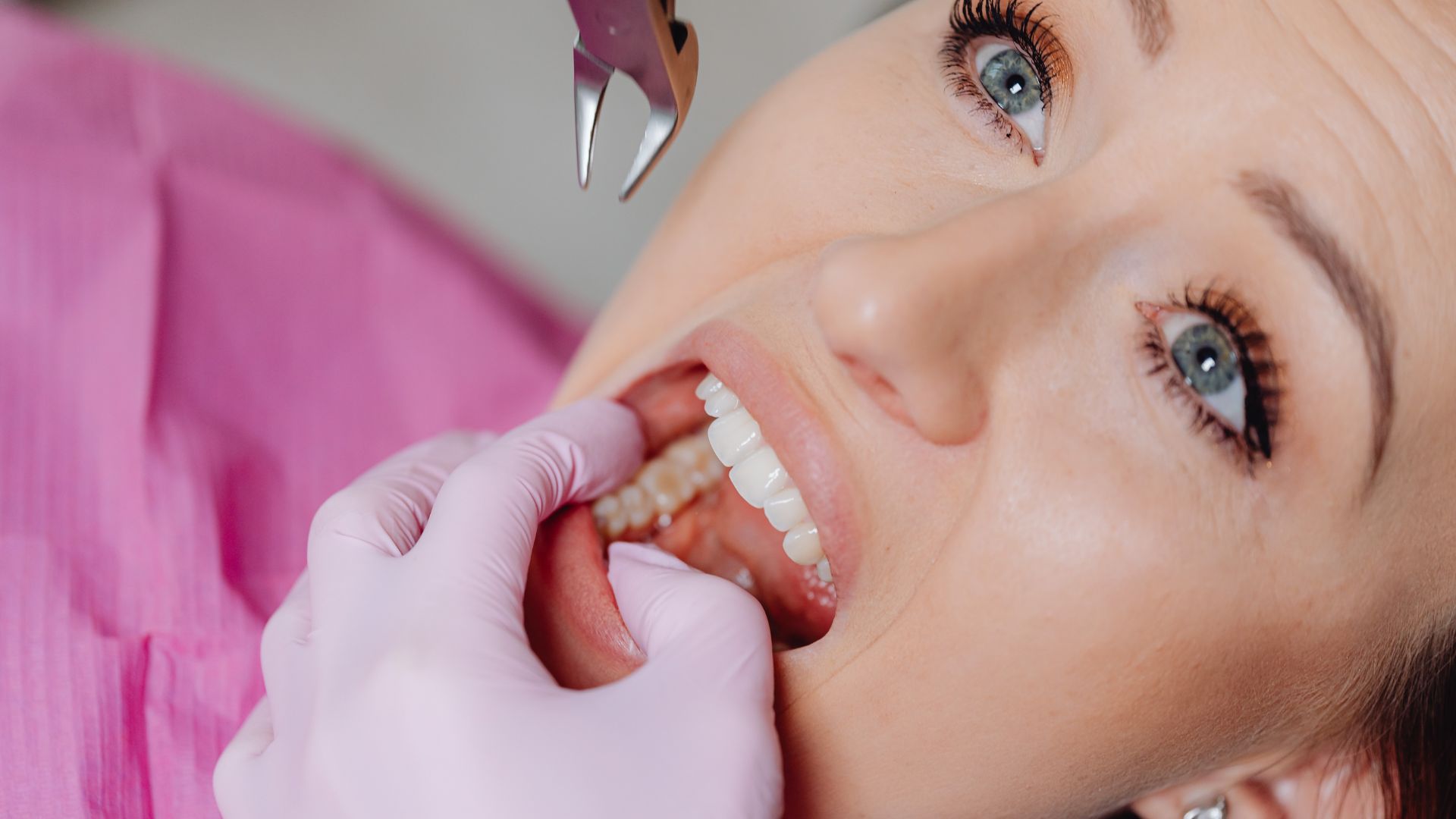 Choosing the Right Dentist for Tooth Extractions: Key Considerations