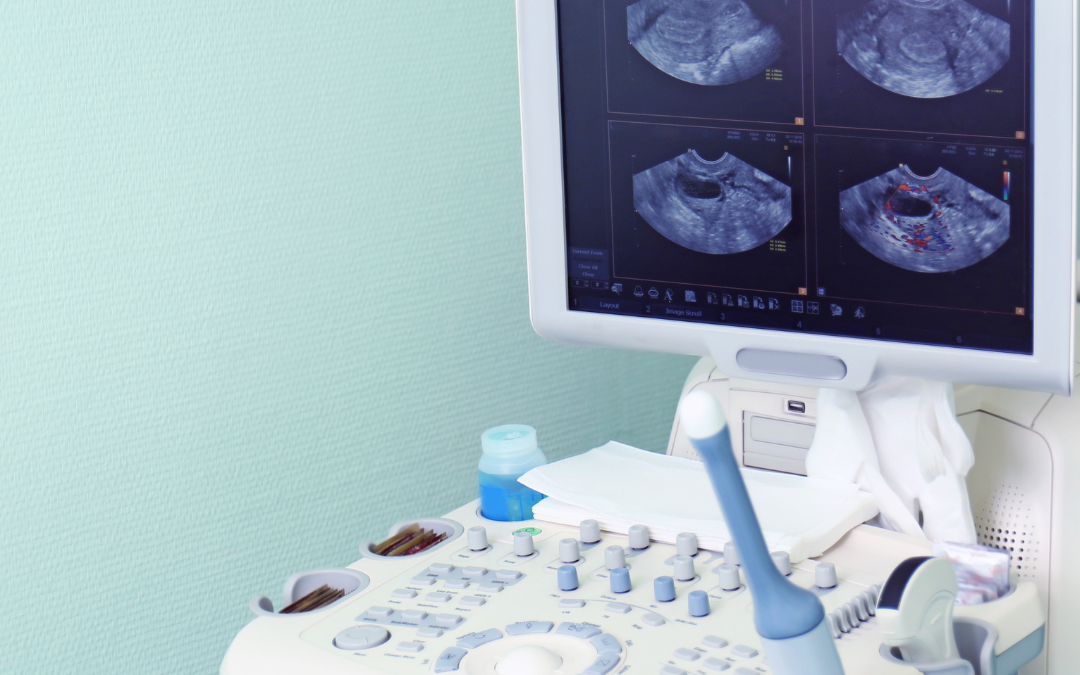 ultrasound scan price