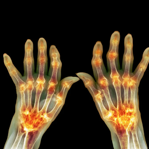 rheumatologist near me
