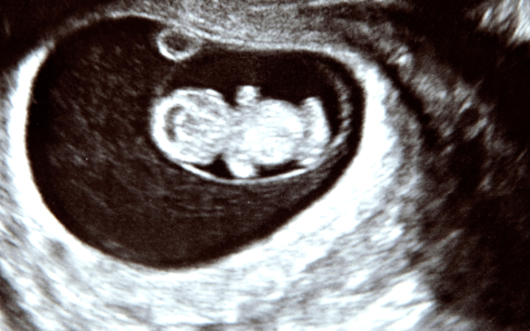 Early Scan Near Me